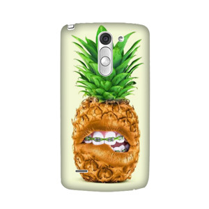  Pineapple Edition Casing HP