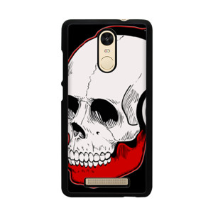 ART V1 Casing HP