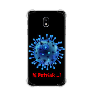 Hi Patrick Casing HP