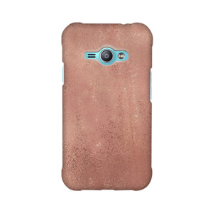 Pure Rose Gold Casing HP