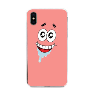Dkfmfmf Casing HP