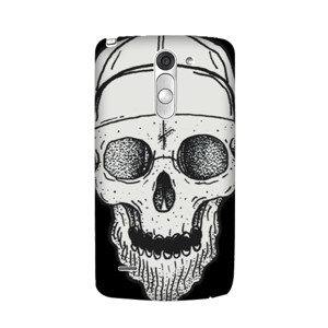 SWAG SKULL Casing HP