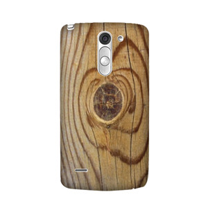 aksesoris hp Casing HP