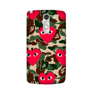 come de garcon Casing HP